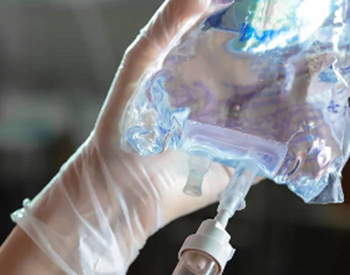 A gloved hand holds an intravenous (IV) fluid bag with a connected tube.